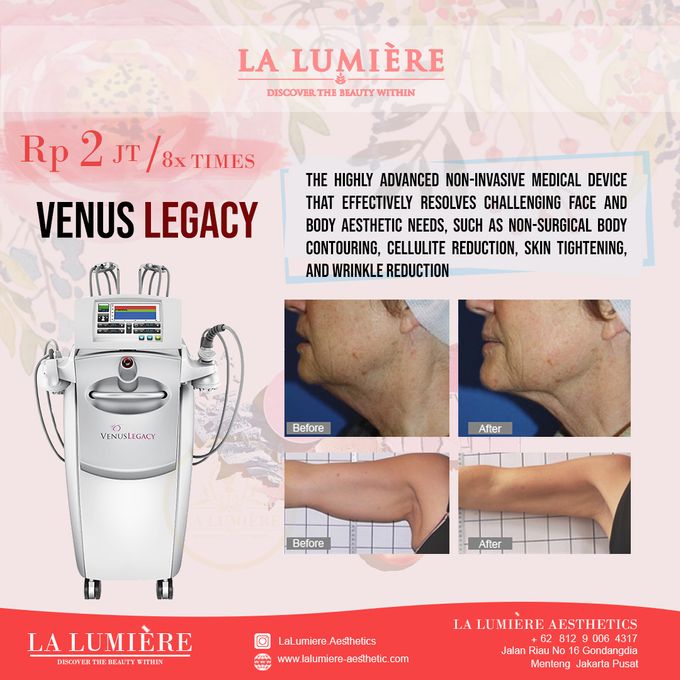 VENUS LEGACY by la lumiere aesthetics - 001 VENUS LEGACY by la lumiere aesthetics - 001