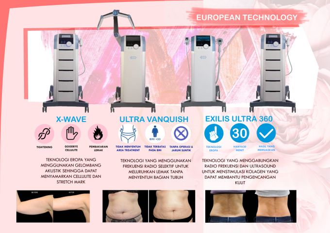 BTL COMBO SLIMMING TREATMENT by la lumiere aesthetics - 002 BTL COMBO SLIMMING TREATMENT by la lumiere aesthetics - 002