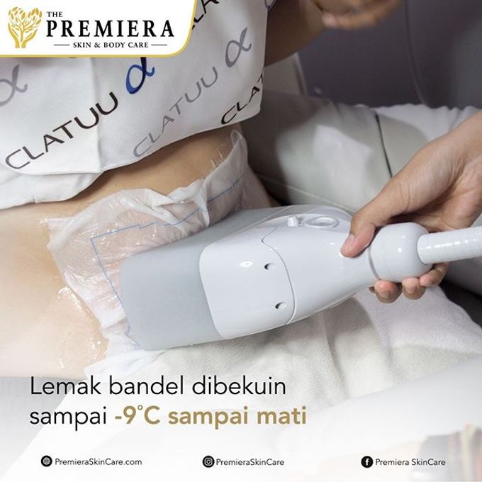 PREMIER Fat Freeze360 by Premiera Skincare - 010 PREMIER Fat Freeze360 by Premiera Skincare - 010