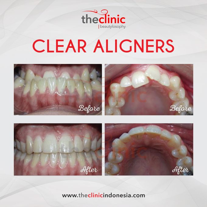 Dental Care by The Clinic Beautylosophy - 003 Dental Care by The Clinic Beautylosophy - 003