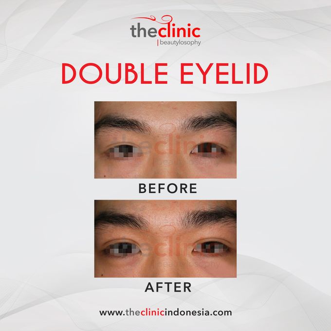Plastic Surgery by The Clinic Beautylosophy - 007 Plastic Surgery by The Clinic Beautylosophy - 007