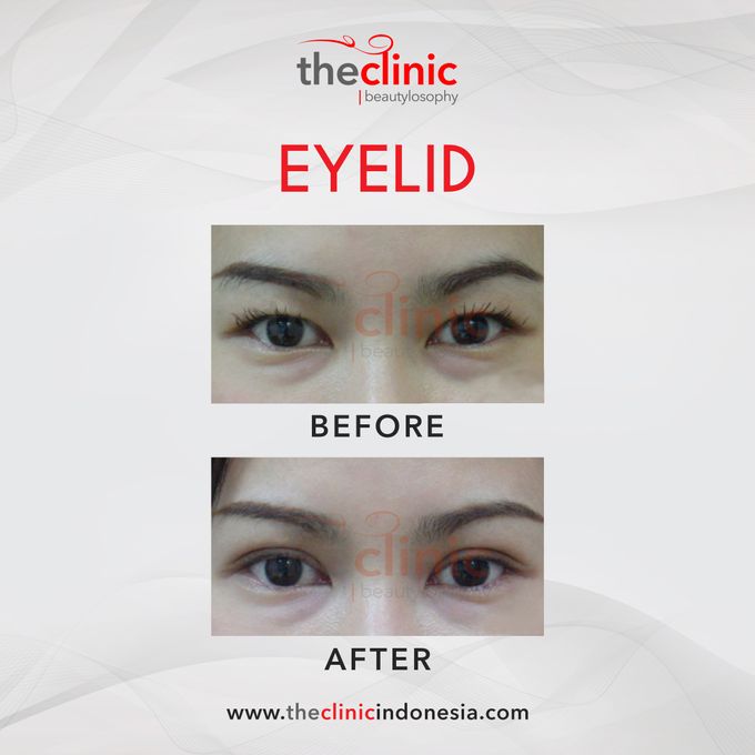 Plastic Surgery by The Clinic Beautylosophy - 008 Plastic Surgery by The Clinic Beautylosophy - 008