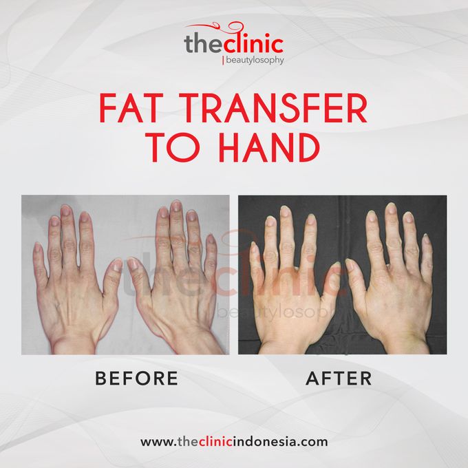 Plastic Surgery by The Clinic Beautylosophy - 010 Plastic Surgery by The Clinic Beautylosophy - 010