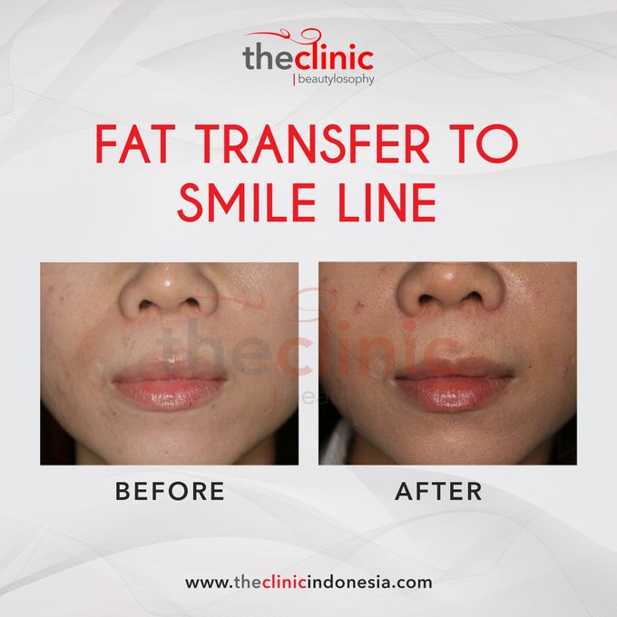 Plastic Surgery by The Clinic Beautylosophy - 009 Plastic Surgery by The Clinic Beautylosophy - 009