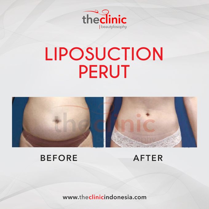 Plastic Surgery by The Clinic Beautylosophy - 003 Plastic Surgery by The Clinic Beautylosophy - 003