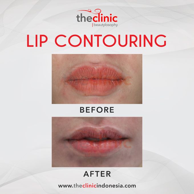 Plastic Surgery by The Clinic Beautylosophy - 005 Plastic Surgery by The Clinic Beautylosophy - 005