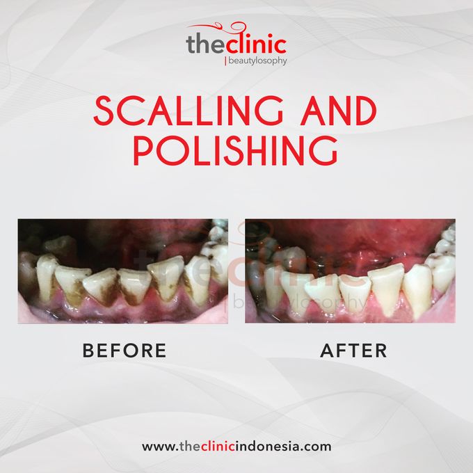 Dental Care by The Clinic Beautylosophy - 004 Dental Care by The Clinic Beautylosophy - 004