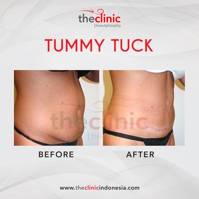 Plastic Surgery by The Clinic Beautylosophy - 011 Plastic Surgery by The Clinic Beautylosophy - 011