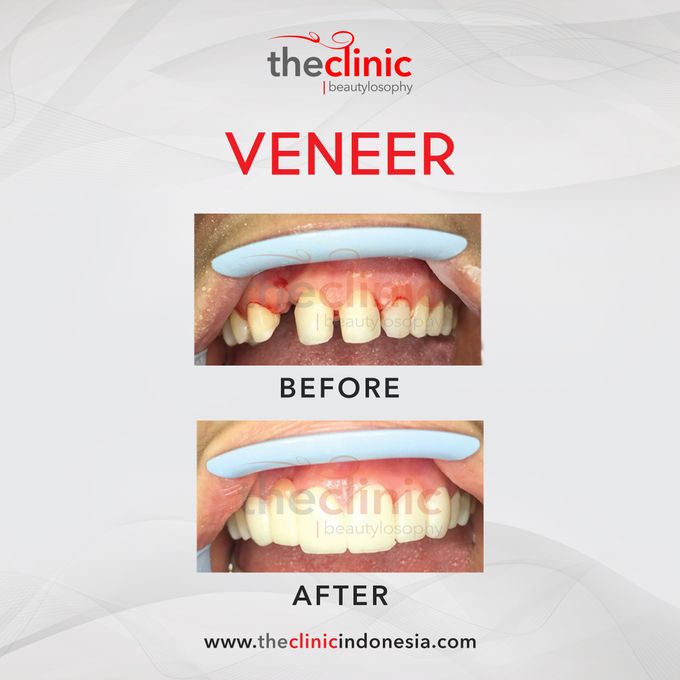 Dental Care by The Clinic Beautylosophy - 006 Dental Care by The Clinic Beautylosophy - 006
