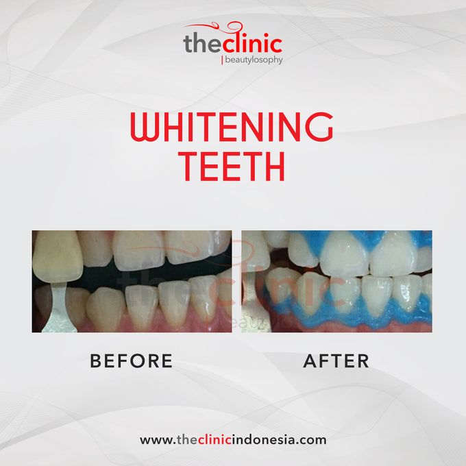 Dental Care by The Clinic Beautylosophy - 005 Dental Care by The Clinic Beautylosophy - 005