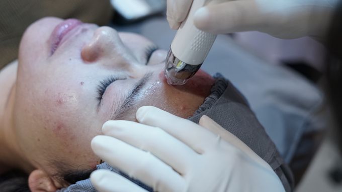 ERHA Acneact - Acne Cure Program by ERHA Dermatology - 002 ERHA Acneact - Acne Cure Program by ERHA Dermatology - 002